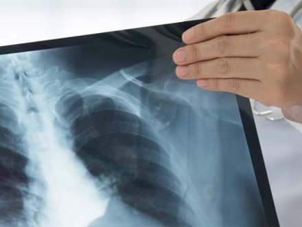 شبکه بهداشت ودرمان طالقان مجهز به دستگاه دیجیتال رادیولوژی شد.